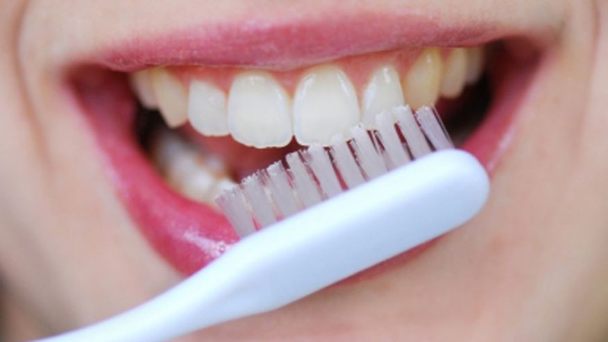 Cara Merawat Gigi Secara Benar Dan Tepat Agar Tetap Sehat
